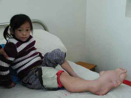 河南大学生患怪病当人肉沙包赚钱 全球恐怖十