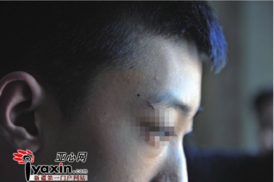 少年拓展培训遭教官体罚 涉事教官承认动手向