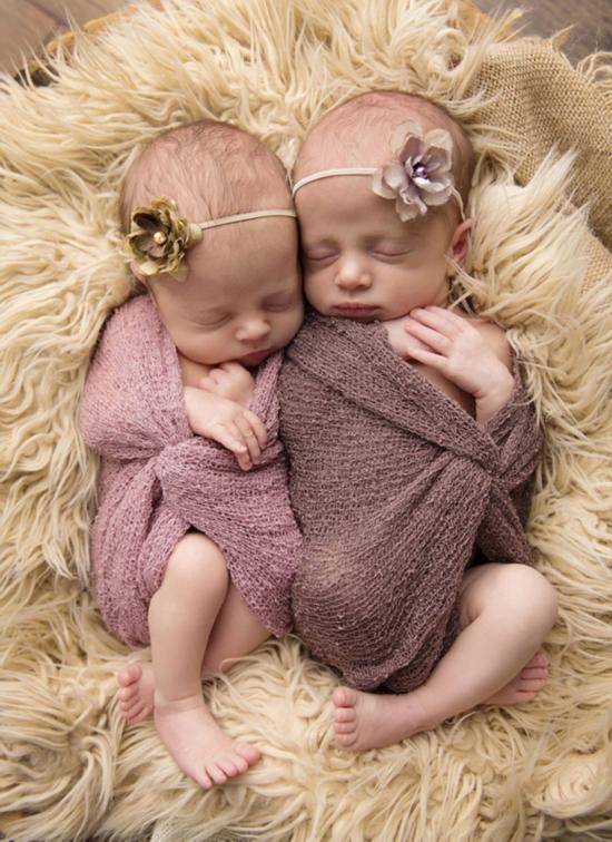 英摄影师拍双胞胎宝宝熟睡照萌翻众人(组图)