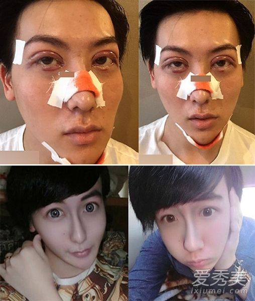 整形界4位奇葩大比拼 妖男自称帅过吴亦凡