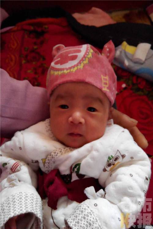 女子被蚊虫叮咬患乙脑 四十多天长睡不醒