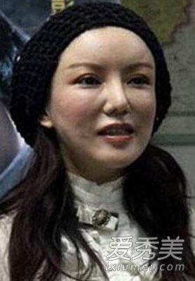 Baby郑爽郑丽媛刘晓庆 整容后遗症找谁哭!