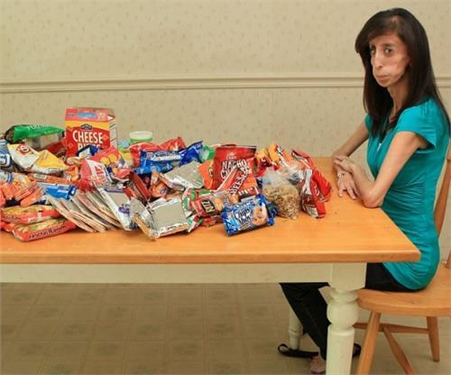 世界最丑女长啥样:世界最丑女人拍纪录片 以笑