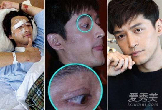  胡歌前女友 江疏影 发文  胡歌车祸真相及对比照