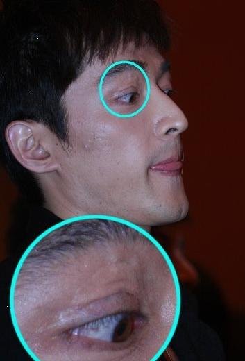 意外惨 毁容 的明星: 俞灏明 烧伤胡歌车祸  毁容 前