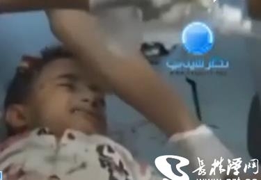 也门6岁 男孩哀求别埋掉我  浑身弹片 网友:请停