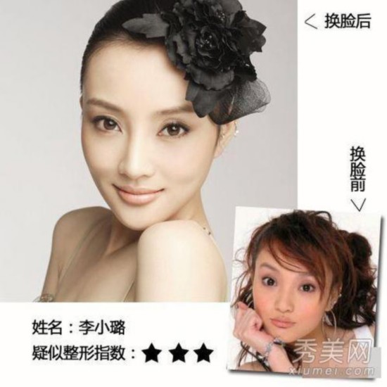 柳岩承认整容打瘦脸针 盘点疑似整容明星