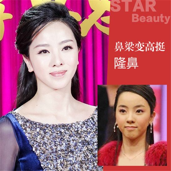 李思思整容的部位并不是很多