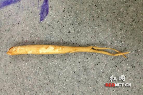 长沙一菜地挖出土人参 男子误食险送命\/图