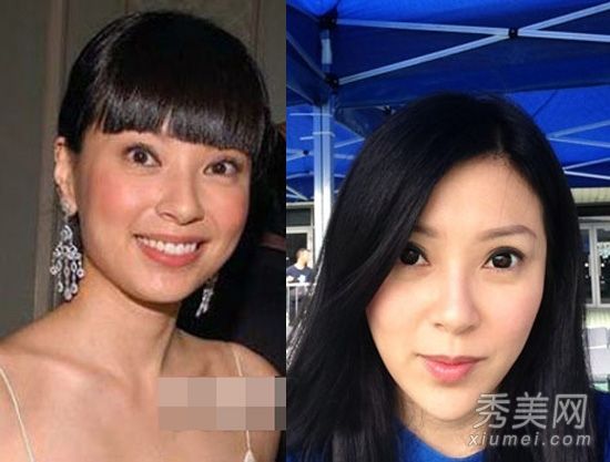tvb女星容貌变残 杨怡傅明宪疑似整容过度