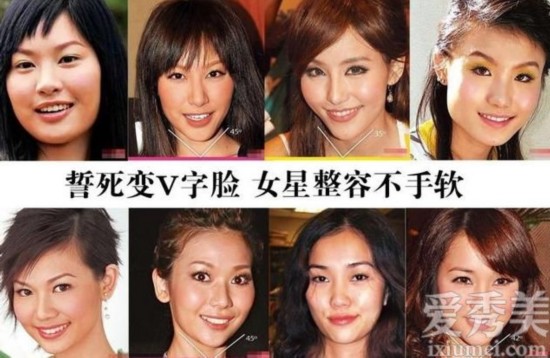 香港女星整容前后对比照