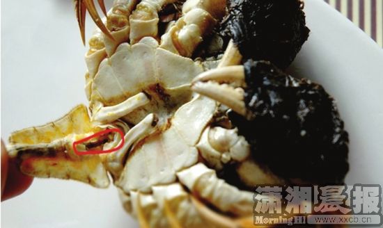 男子吃两只大闸蟹过敏休克 全身出现大片风疹