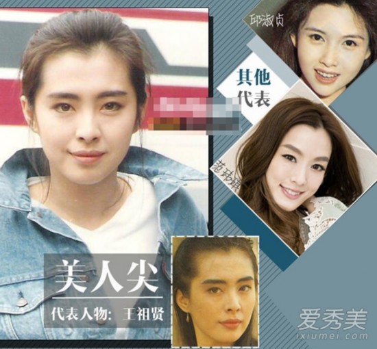 美人尖