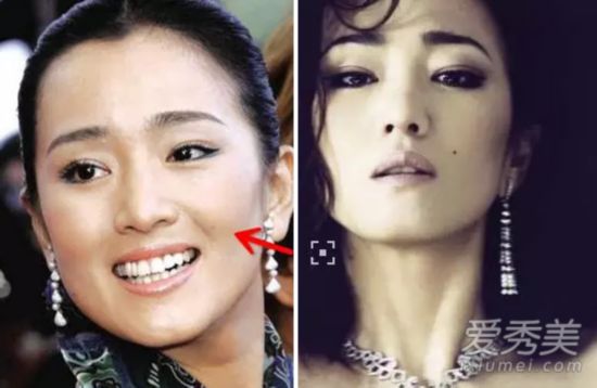 孙俪下巴痣巩俐魅力痣 女星脸上"美痣"有啥寓意