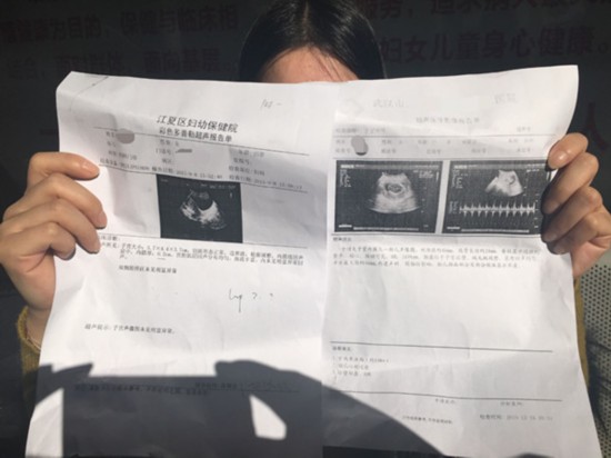 女子被诊断为月经不调 服药多日后已怀孕5个月
