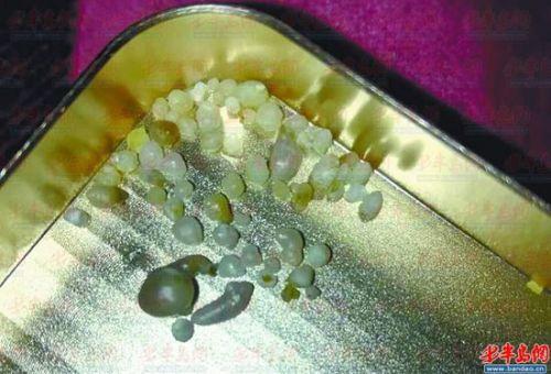 运气爆棚:男子买海蛎子吃出珍珠 盘点吃出名贵