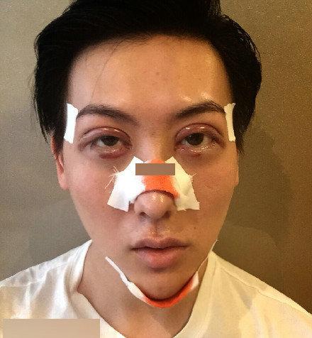 蛇精男晒身份证称仅15岁 网友吐槽:当我瞎?(图