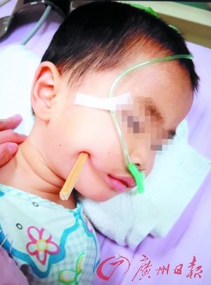 两岁男童摔倒筷子插入脑袋 熊孩子吃饭看动画