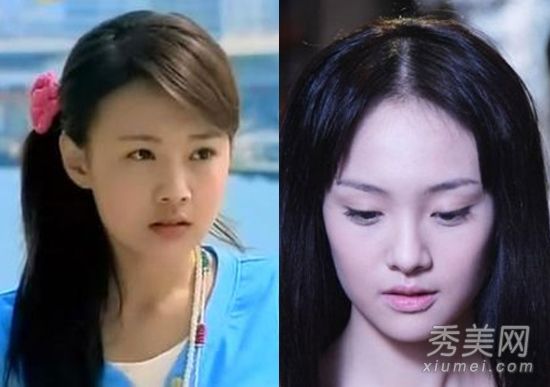 郑爽周韦彤李菲儿 作死整容变残的明星们