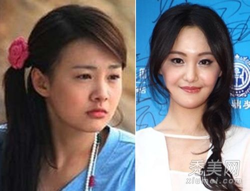郑爽周韦彤李菲儿 作死整容变残的明星们