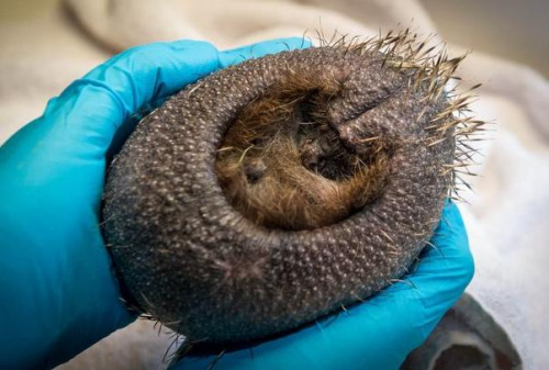 英国一刺?患秃头症体刺寥寥无几 或由于压力导