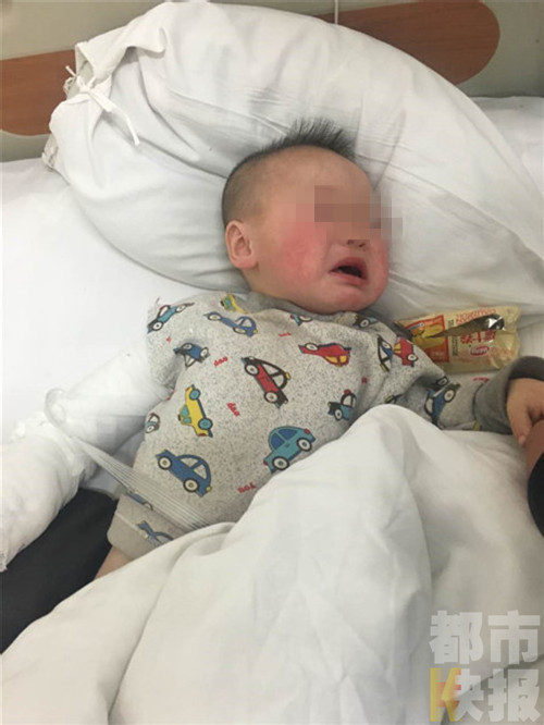 一岁半男婴右臂夹进三轮车拇指断裂 胳膊七八