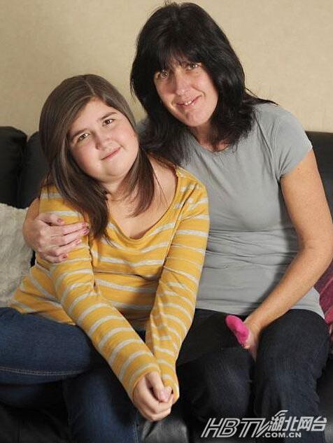  少年患病似吸血鬼  千奇百怪的疾病除了吸血鬼