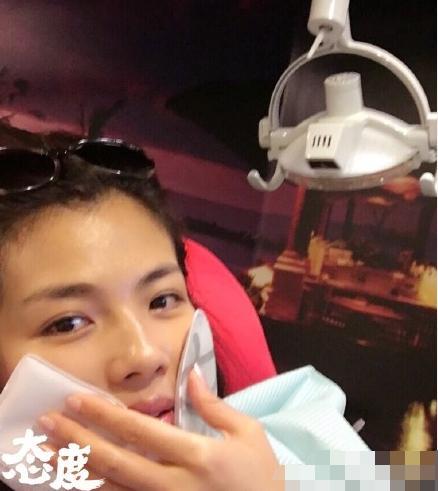 刘涛自曝曾整全口美容牙 捂嘴劝网友没事别换