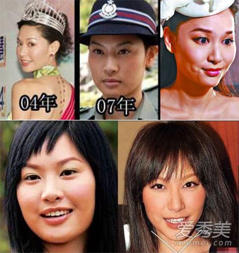 香港女星整容更大胆 谢安琪撞脸刘晓庆