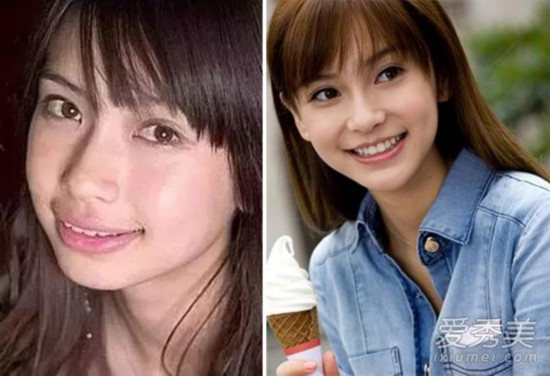 香港女星整容更大胆 谢安琪撞脸刘晓庆