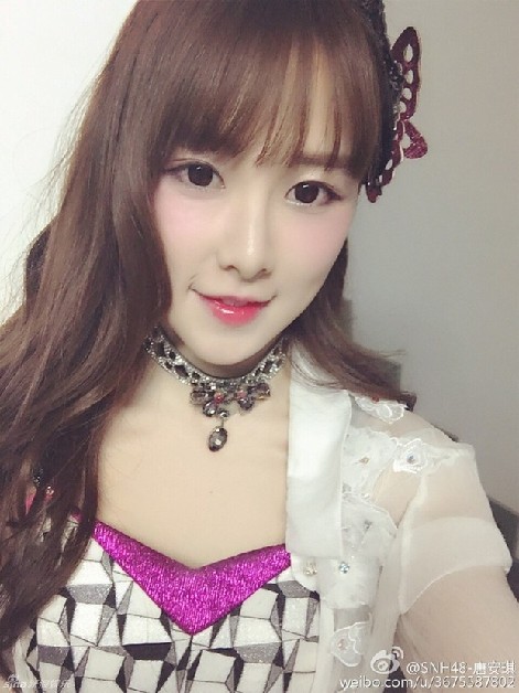 組圖：SNH48唐安琪嚴重燒傷 私照甜美清純