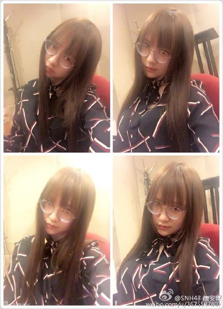 組圖：SNH48唐安琪嚴重燒傷 私照甜美清純