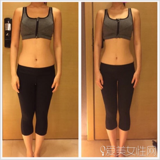  梨形妹的瘦腿經：堅持慢跑一個月大腿減3cm 