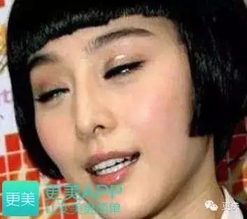 让张雨绮变吊带的偷拍胸,是惹毛星爷的双眼皮性感不是性感图片