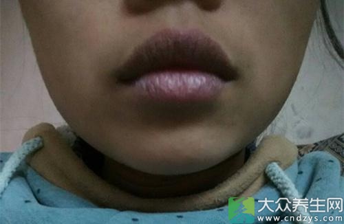 嘴唇发黑的原因