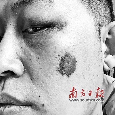 电动平衡车事故频出 涉事公司称产品不存在设