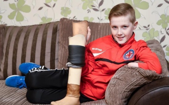 励志!12岁男孩靠一只胳膊一条腿成足球队长