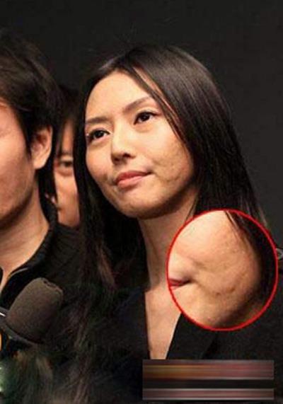  杨幂自曝脸上巨痘 世界崩溃 图揭女星惨不忍睹