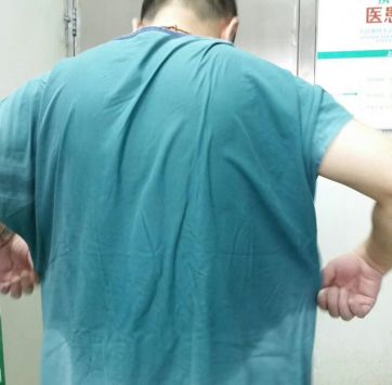 西京医院3·15当日内镜微创救了两孩子命
