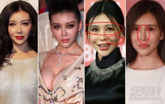 郑爽李小璐巩新亮…那些整容