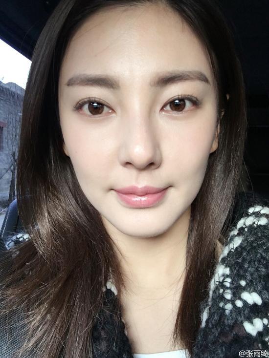 张雨绮晒自拍发肿嘴唇抢镜 网友调侃:亲肿了(图