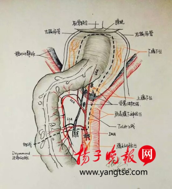 [综合] 医生手绘手术解剖图 患者"秒懂"手术过程[复制链接]