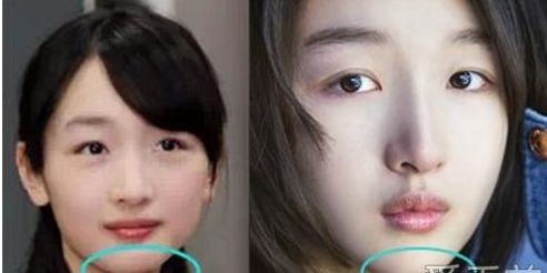 周冬雨登大片封面 周冬雨割双眼皮整容了吗?