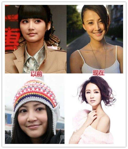 张歆艺以前现在对比照