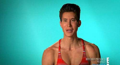 女子变沙漏身材真相骇人(图)盘点匪夷所思的人