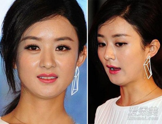 2015年颜值下跌的女星 郑爽Angelababy赵丽颖