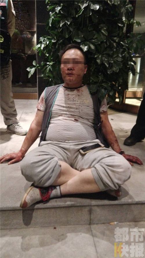西安代驾司机浑身是血称被一休闲会馆保安殴打
