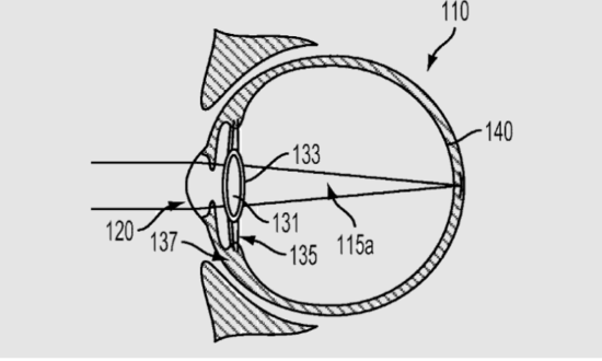 谷歌新专利：电子镜片植入眼球 矫正视力还能拍照