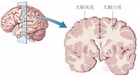 简直太惊悚 玩手机上瘾竟会导致脑萎缩?