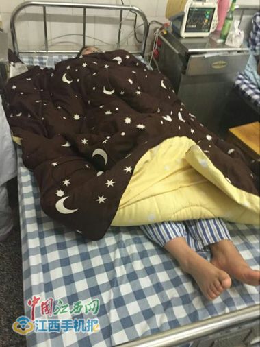 伤不起!赣州一女大学生左锁骨术后9个月又见骨